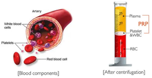 PRP and Anti-Aging flawlesseternalbeauty