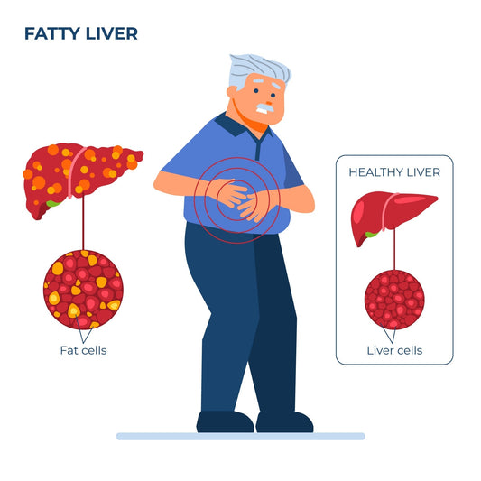 The Rising Epidemic of Preventable Fatty Liver Disease flawlesseternalbeauty