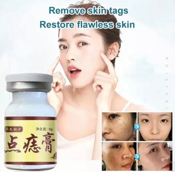 Apgar Herbal Skin Tag Removal Cream 5g flawlesseternalbeauty