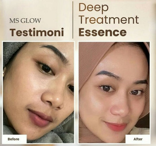 Ms Glow Deep Treatment Essence with Salmon DNA