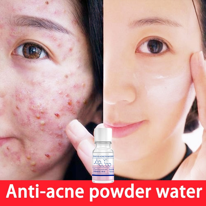 Pink Diacid Acne Powder Water 10ml flawlesseternalbeauty