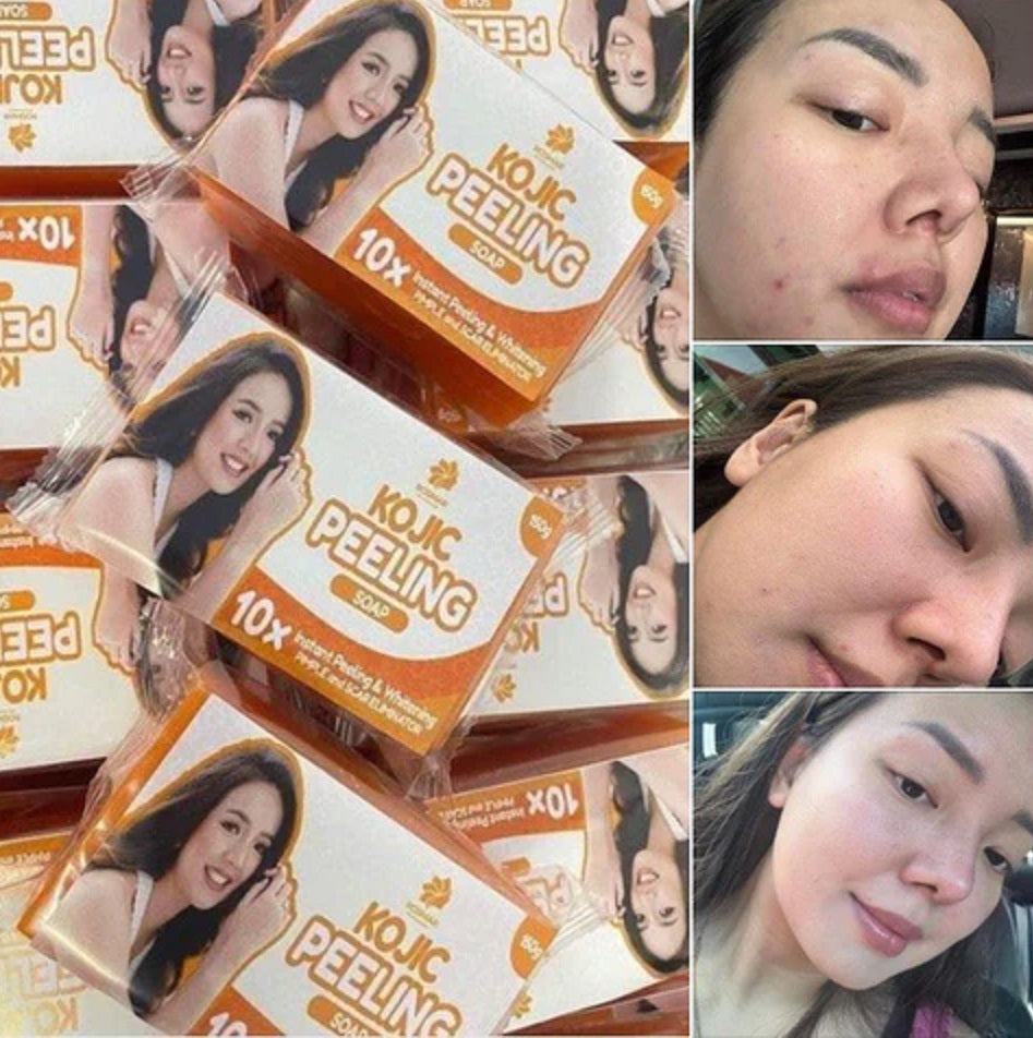 Rosmar Kojic 10X Peeling Soap 150g