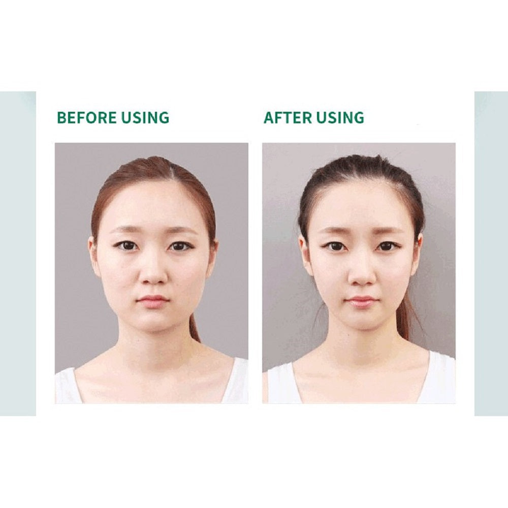 Anti Double Chin V Shape Anti-Gravity Hydrogel Mask