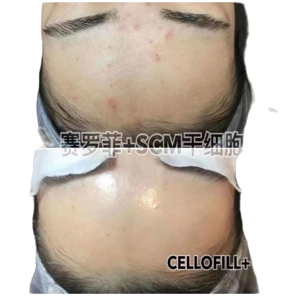 Korea Glamour Care SCM Stem Cells