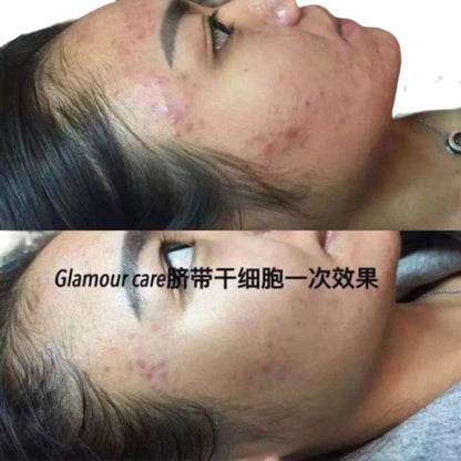 Korea Glamour Care SCM Stem Cells